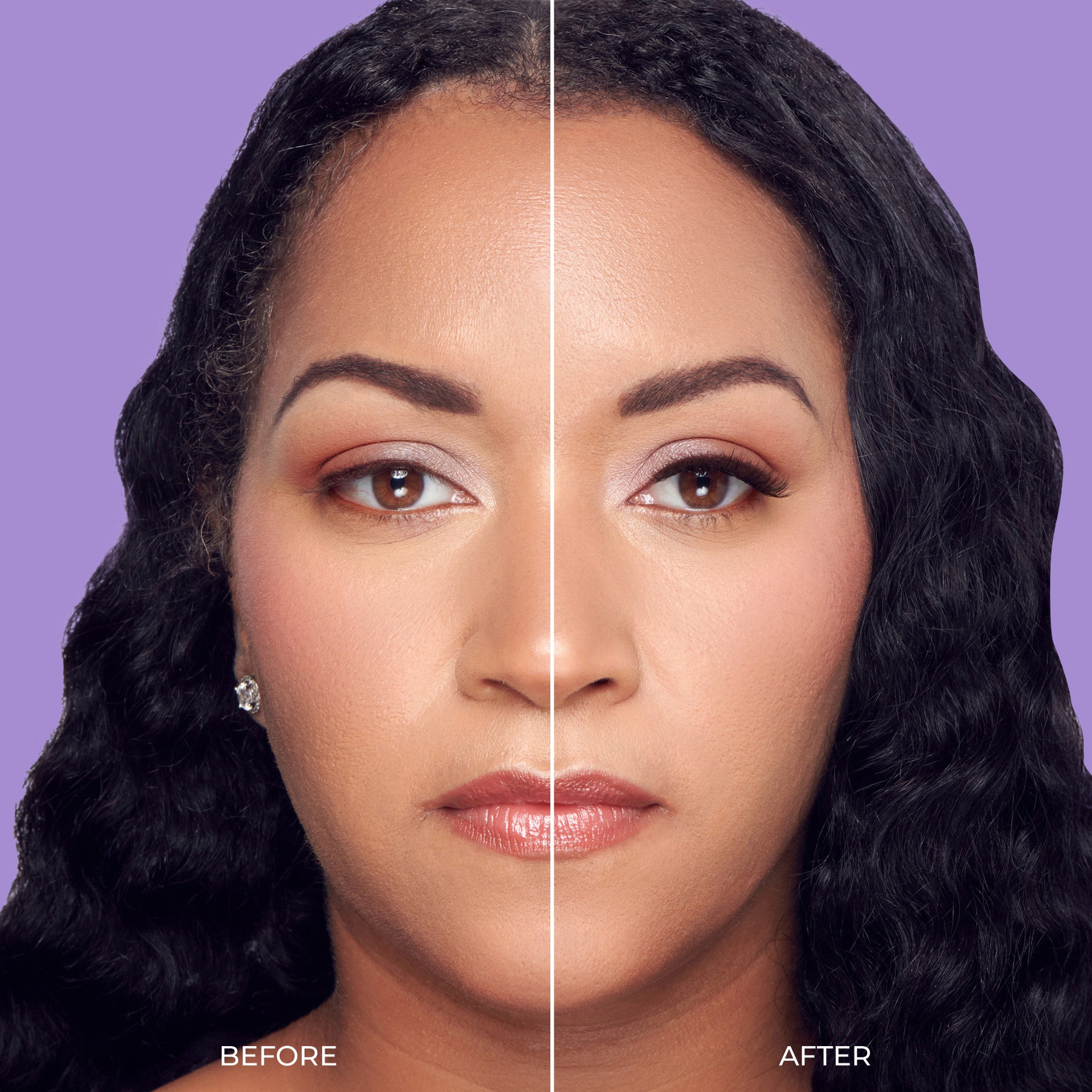 Before and after facial comparison showing skin texture and appearance changes against purple background.