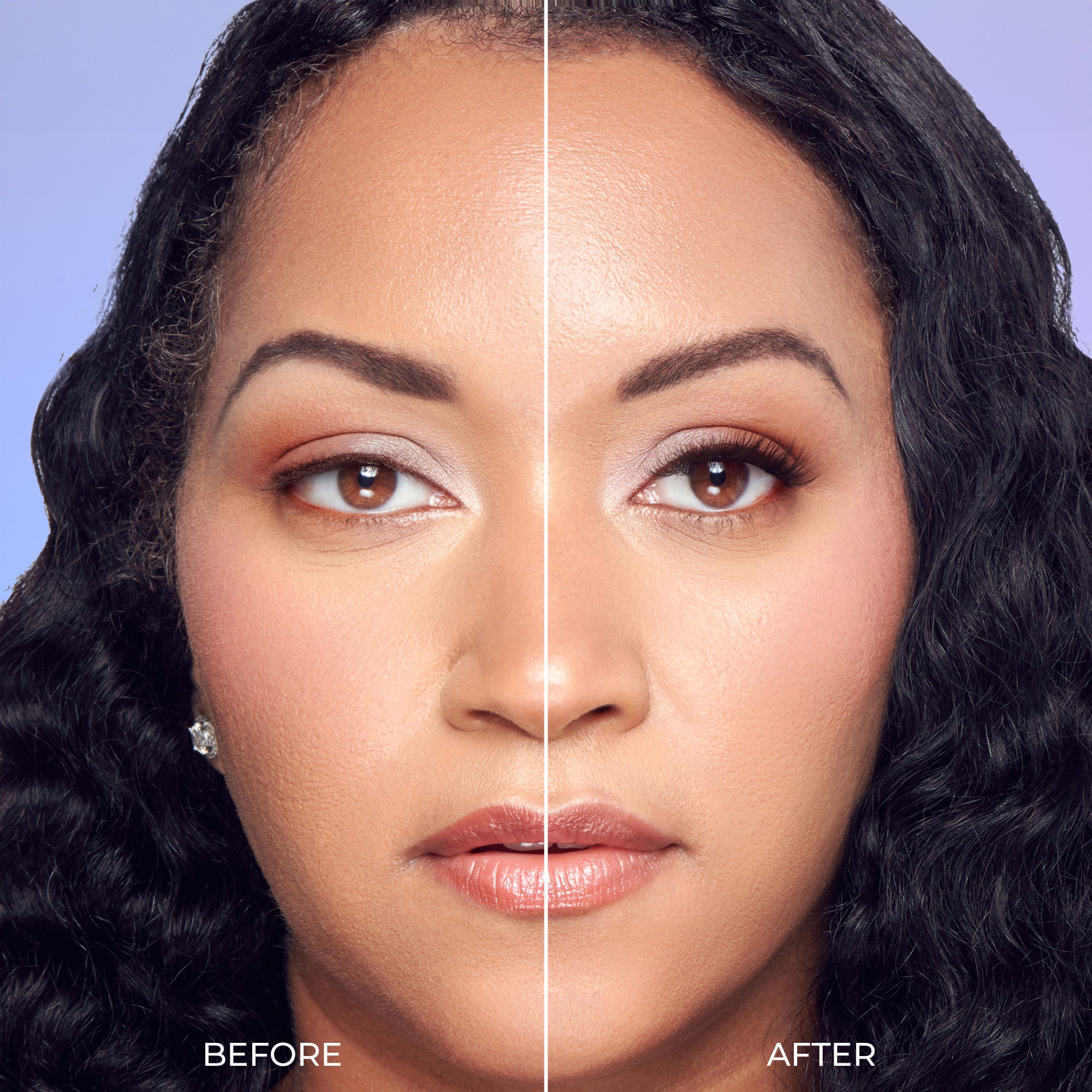 Before and after skincare or cosmetic treatment comparison showing facial changes.