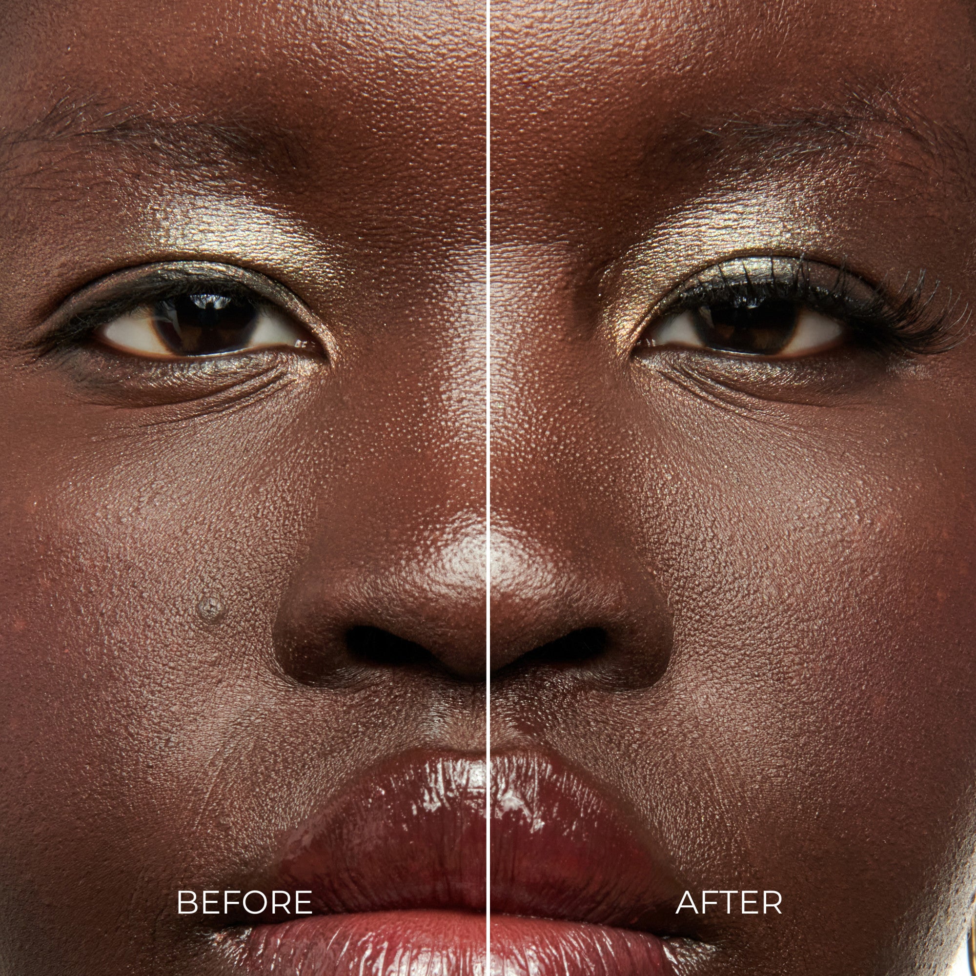 Before and after comparison of a woman&
