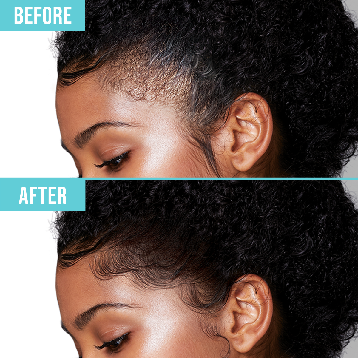 Side profile close-up of a woman’s hairline showing before and after effects of KISS Colors &amp; Care Edge Fixer; edges are smoother and more defined in the after image.