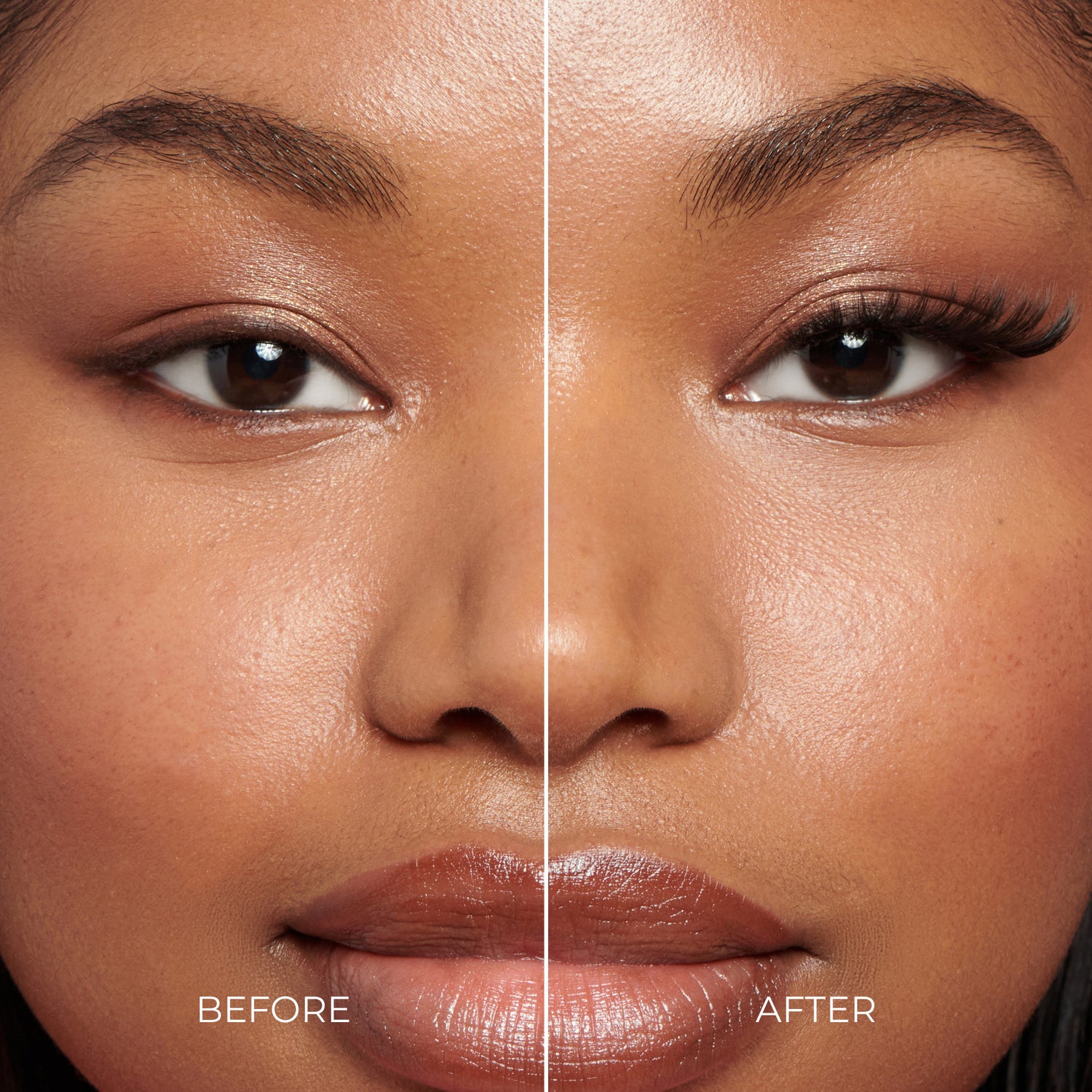 Before and after comparison of a woman&